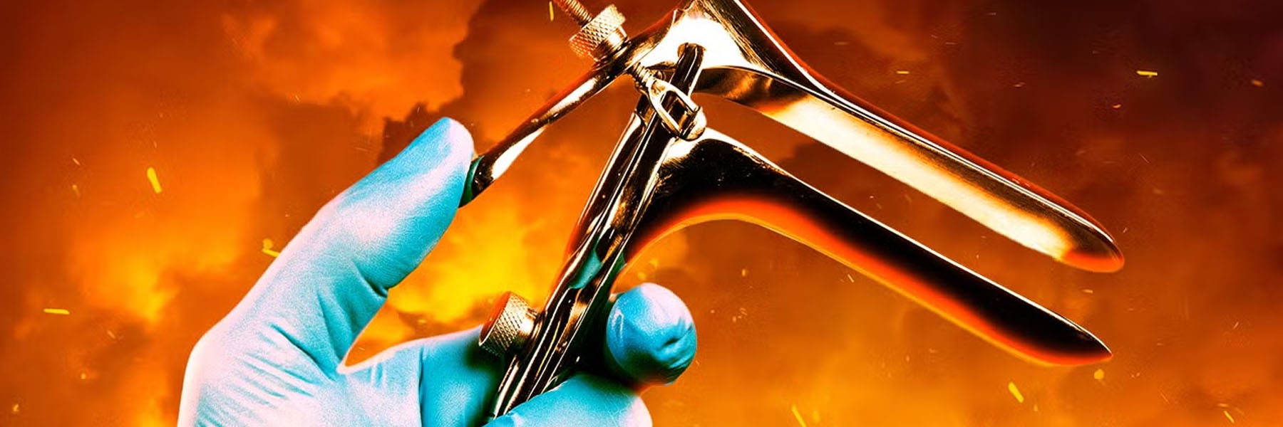 Speculum